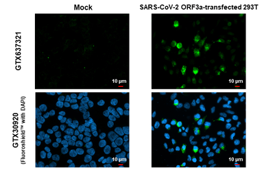 Anti-SARS-CoV-2 (COVID-19) ORF3a antibody [HL1722] used in Immunocytochemistry/ Immunofluorescence (ICC/IF). GTX637321